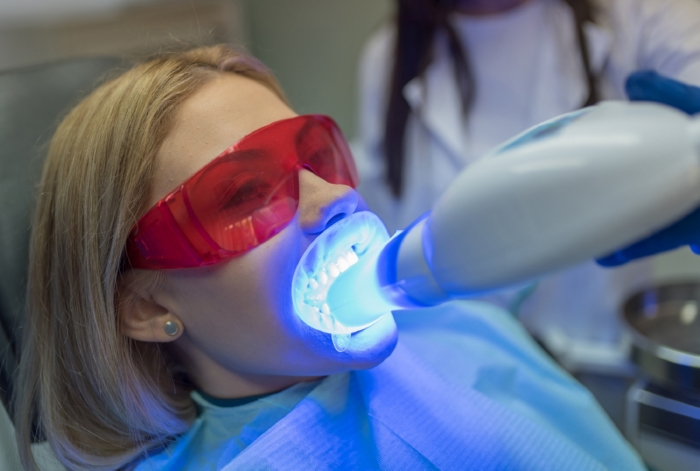 What is Teeth Whitening?