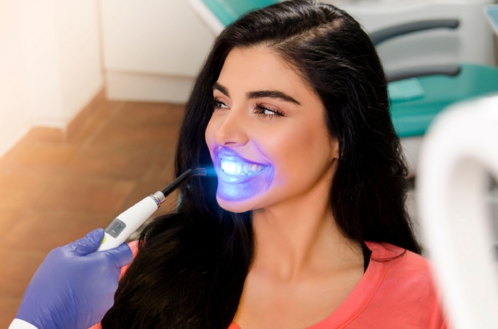 What is Teeth Whitening?